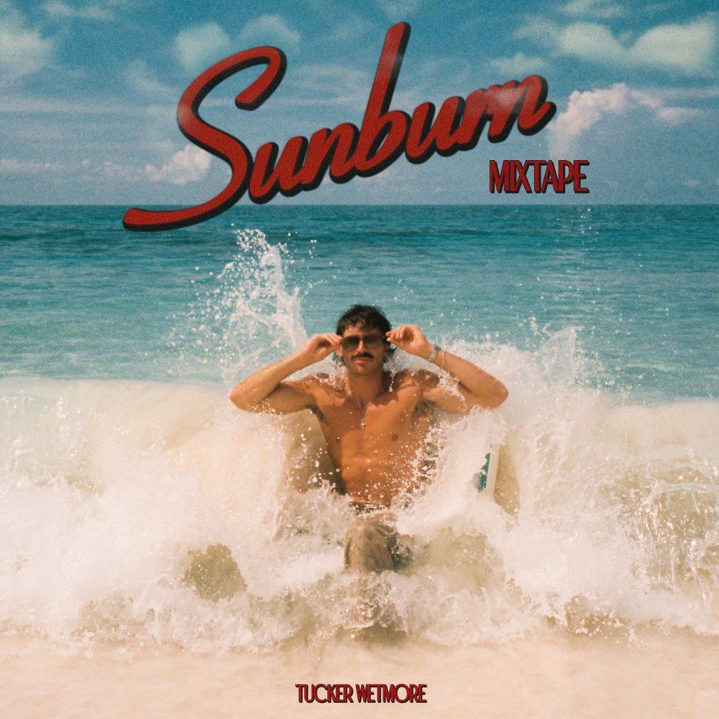 Sunburn