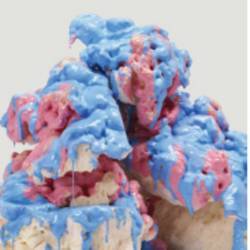 Dross Glop 1